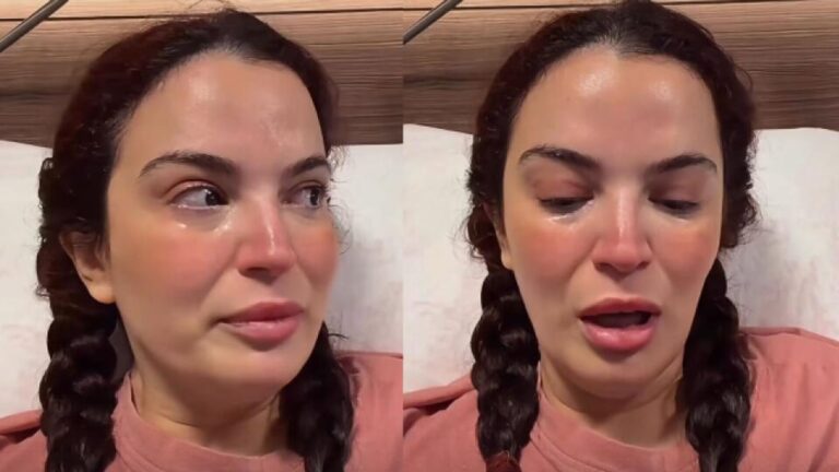 7 kere ameliyat olmustu asli bekiroglu gozyaslariyla paylasti doktorlar ne yapacaklarini bilmiyorlar GSdVCw6r