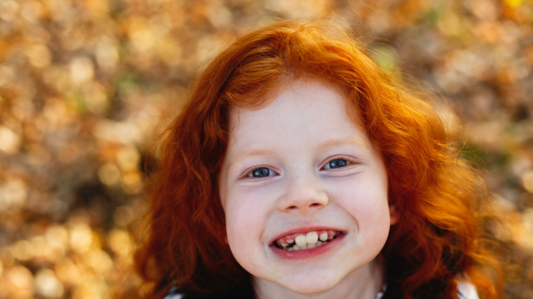 bilim insanlari karsiligini buldu kizil sacin ortaya cikmasinin bir nedeni var 6gQPQead