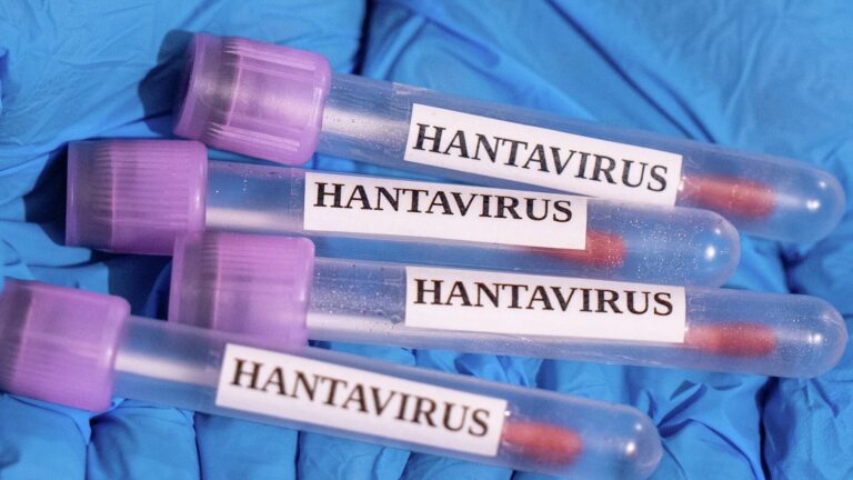 DSÖ uyardı: Hantavirüs belirtiler başladığında en bulaşıcı düzeye ulaşıyor 10 dso uyardi hantavirus belirtiler basladiginda en bulasici duzeye ulasiyor 6wXJbg3R